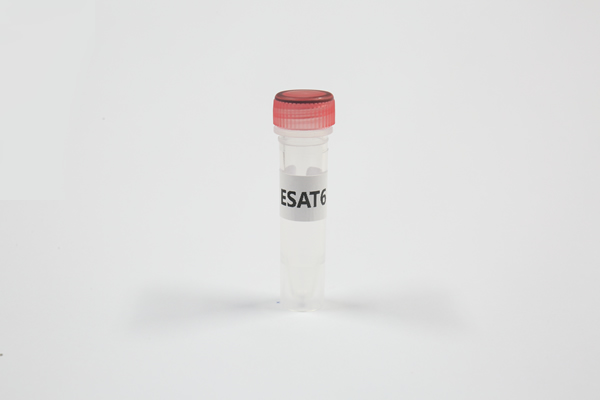 结核分枝杆菌特异抗原ESAT6重组蛋白